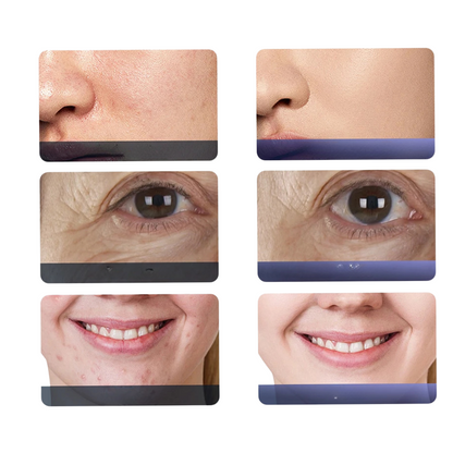 7 Colors LED Photon Machine – Professional Rejuvenation and Hydration