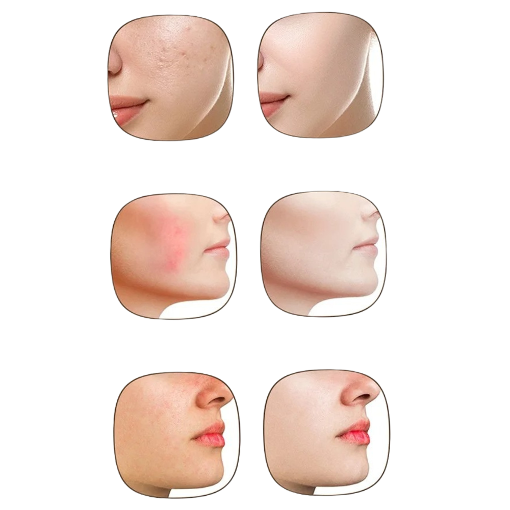 7 Colors LED Silicone Face Mask - Wireless and Rejuvenating